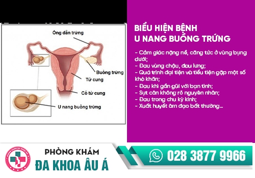 u nang buồng trứng dẫn đến tình trạng đau rát khi quan hệ